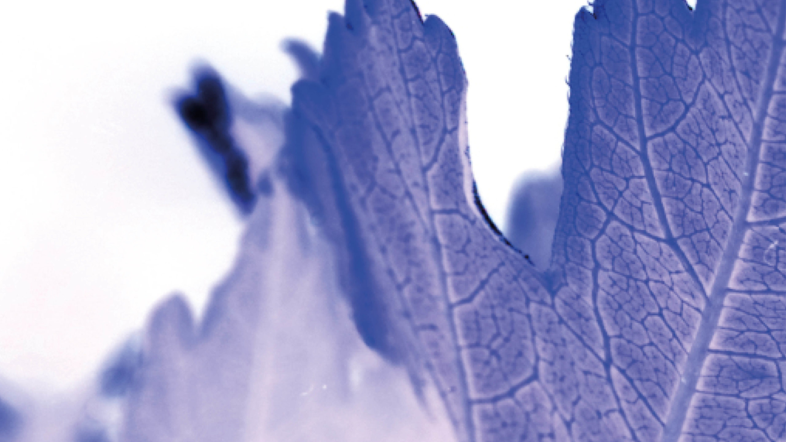 angiographie-cyriellegirod-coaching